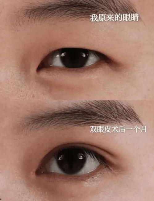 扇形双眼皮韩国明星,打造东方美眸新风尚